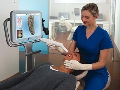 Align iTero scanning Richmond Dental Clinic
